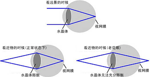 人什么時候得老花眼